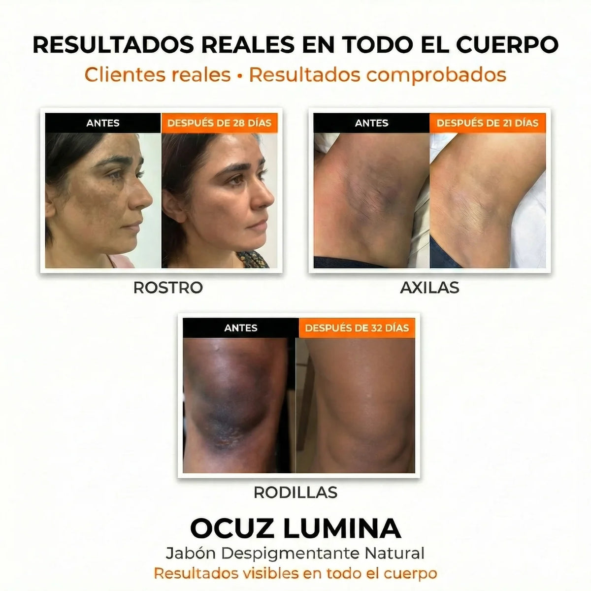 Ocuz Lumina Kojic
