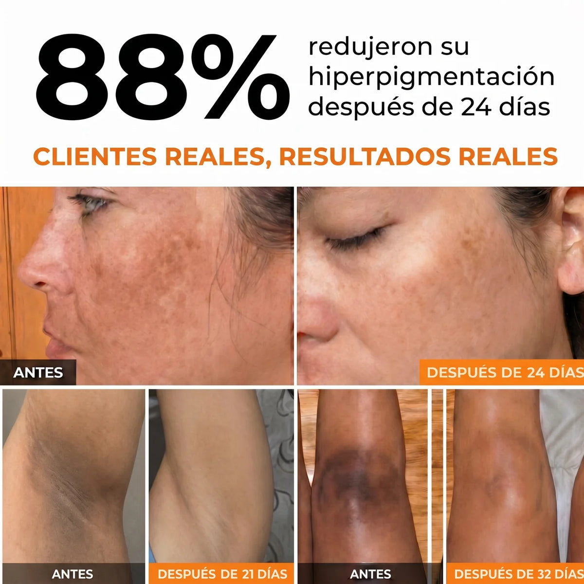 Ocuz Lumina Kojic