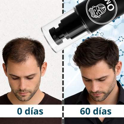 Hair Tonic Om Style
